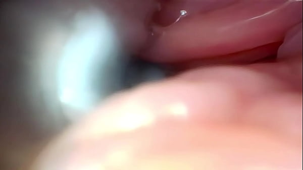 Semen in cervix wide stretching pussy endoscope 