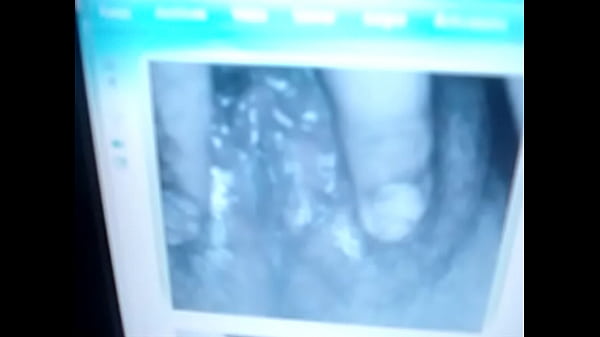 Video bokep part 1663360 