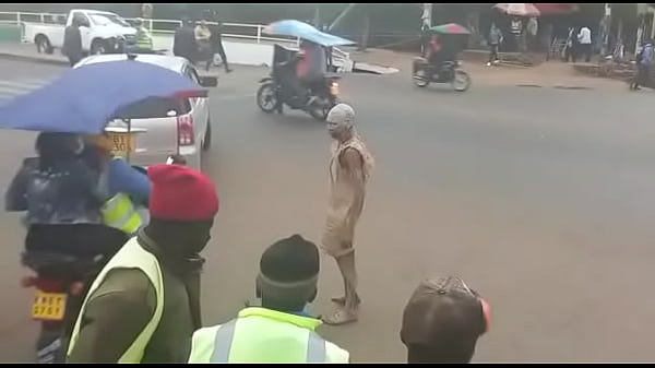 The foreskin remover 