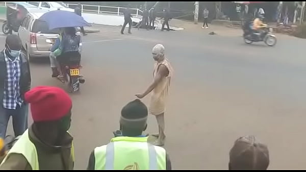 The foreskin remover 