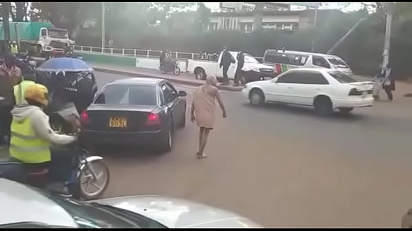 The foreskin remover 