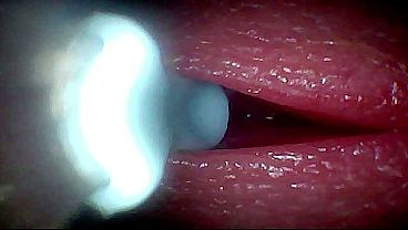 I couldn&rsquo_t believe what happens INSIDE the penis as sperm passes through (endoscopic footage)