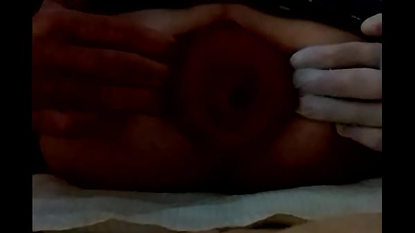 Play MP4 - My prolapse