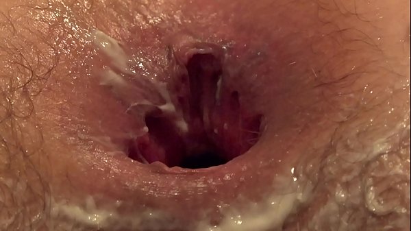 Full anal fisting a fat lesbian stretches her girlfriend's booty and makes her cunnilingus hairy cunt and gaping butt anal fetish