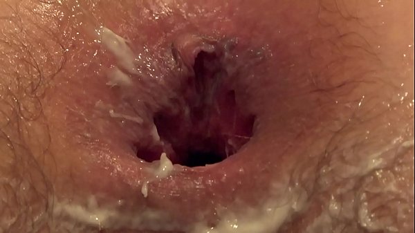 Play MP4 - Anal deep fisting for girlfriend with juicy ass&comma; hairy asshole gaping&comma; and hairy pussy licking&period; Chubby lesbians have fun in the sauna&period; Amateur fetish&period;