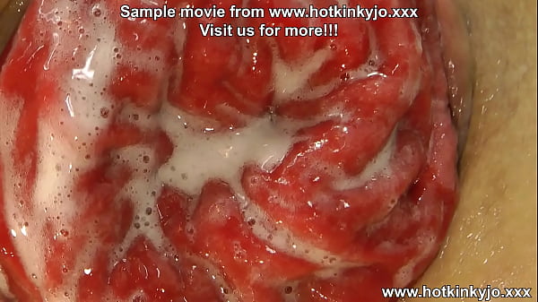 Hkj anal fisting gape & prolapse 15 01 2024