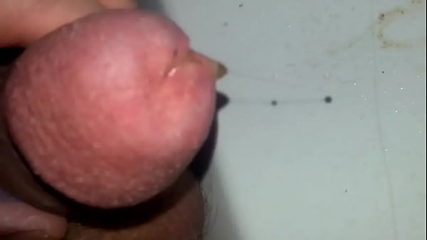 Furtender Schwanz wegen Kohlens&auml;ure Insertion 