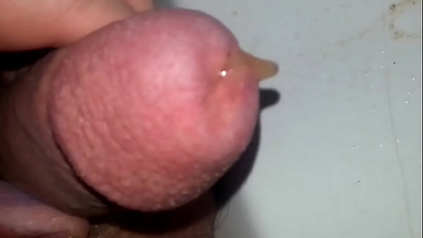 Furtender schwanz wegen kohlens&auml;ure insertion